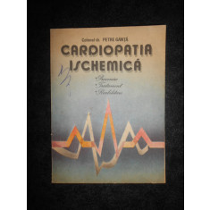 Petre Ganta - Cardiopatia ischemica. Prevenire, Tratament, Reabilitare