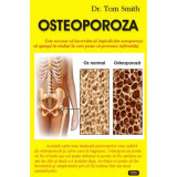 Osteoporoza - Dr. Tom Smith, 2010, Antet