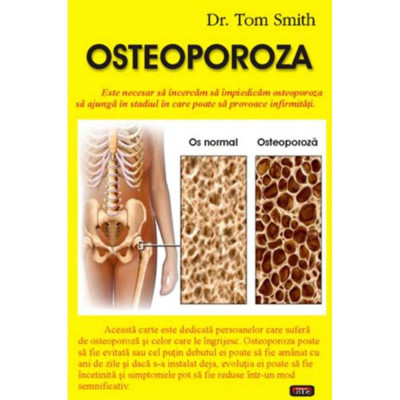 Osteoporoza - Dr. Tom Smith foto