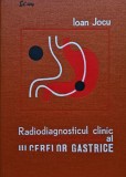 Cumpara ieftin Carte Radiodiagnosticul clinic al ulcerelor gastrice Ioan Jocu 1976 Editura Medicala Cartonata 288 pagini Romana