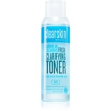 Avon Clearskin Blackhead Clearing apa pentru curatarea tenului impotriva punctelor negre 100 ml