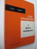 Cum interpretam O electrocardiograma - C. Lian , J. Vilenski