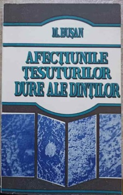 AFECTIUNILE TESUTURILOR DURE ALE DINTILOR-M. BUSAN-217553 foto