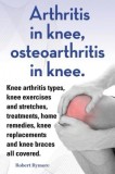 Arthritis in Knee, Osteoarthritis in Knee. Knee Arthritis Types, Knee Exercises and Stretches, Treatments, Home Remedies, Knee Replacements and Knee B