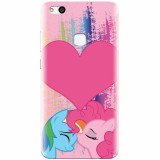 Husa silicon pentru Huawei P10 Lite, Pinkie Kiss