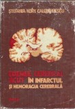 Edemul cerebral acut in infarctul si hemoragia cerebrala - Stefania Kory Calomfirescu
