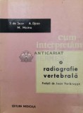 Cum interpretam o radiografie vertebrala - 1965 - S. de Seze ($W84)