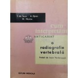 Cum interpretam o radiografie vertebrala - 1965 - S. de Seze ($W84)