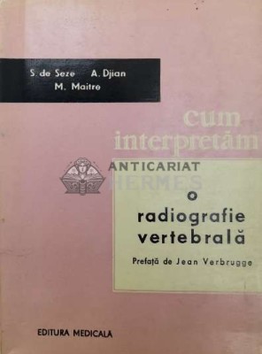 Cum interpretam o radiografie vertebrala - 1965 - S. de Seze ($W84) foto
