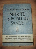 Nefrite si boale de sange- Gh. Tudoranu