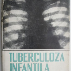 Tuberculoza infantila Forme clinice, diagnostic, profilaxie si tratament – Ioan Nicolau