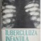 Tuberculoza infantila Forme clinice, diagnostic, profilaxie si tratament &ndash; Ioan Nicolau