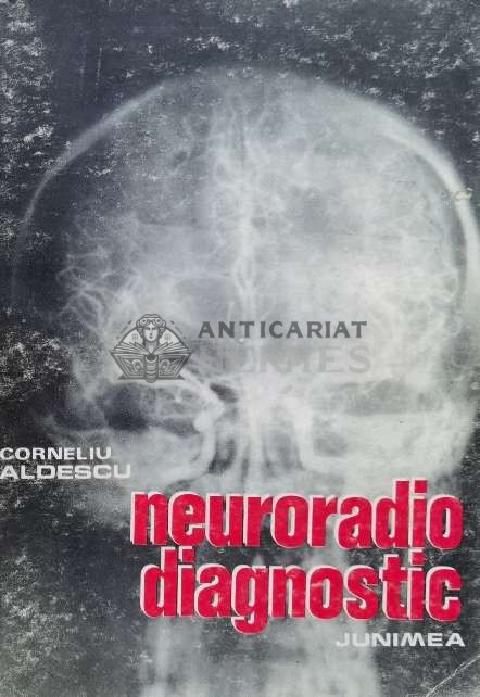 Neuroradio diagnostic. Craniul si continut (volumul 1) - 1982 - Corneliu Aldescu (H57)