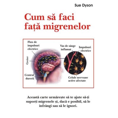 Cum sa faci fata migrenelor - Sue Dyson foto