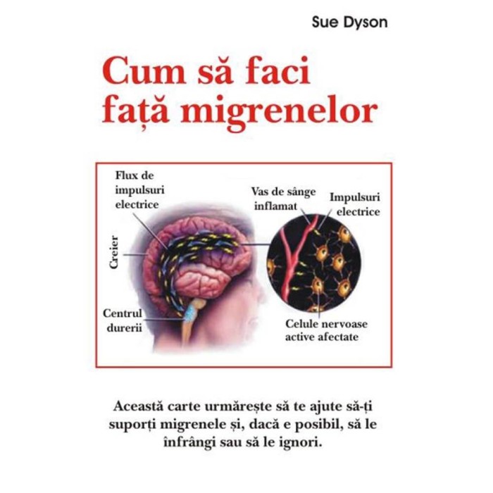 Cum sa faci fata migrenelor - Sue Dyson