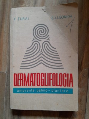 Dermatoglifologia, ampremte planto plantare - C. Turai foto