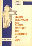 LEZIUNI FRACTURARE ALE OASELOR DIAFIZARE ALE MEMBRELOR LA COPII-LEONIDA-265435