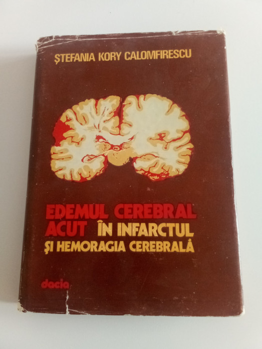 Edemul cerebral acut &icirc;n infarctul și hemoragia cerebrala - S. K. Calomfirescu