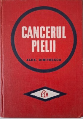 Cancerul pielii &amp;ndash; Alex. Dimitrescu foto