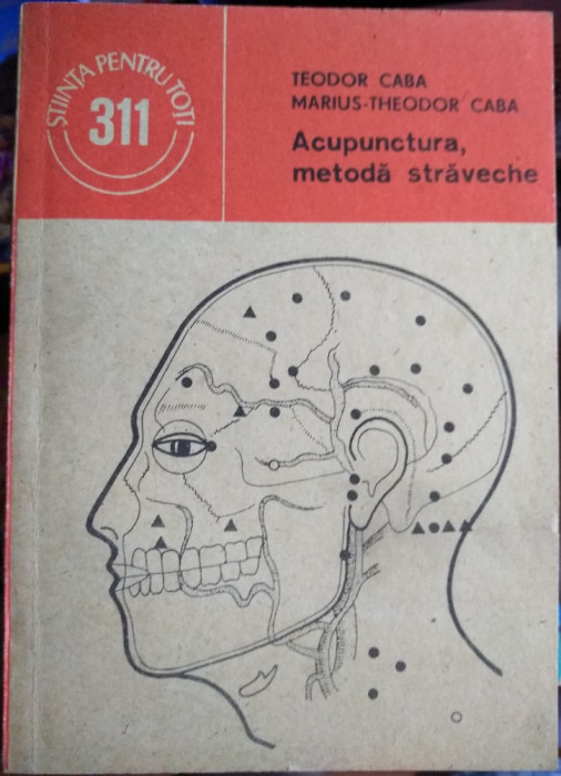 Acupunctura, metodă străveche