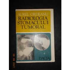 AUREL ORDEANU - RADIOLOGIA STOMACULUI TUMORAL