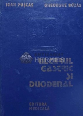 Ulcerul gastric si duodenal - 1986 - Gheorghe Buzas (AI16) foto