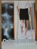 Osteoporoza Cauze si Prevenire - Emil Radulescu, Viata si Sanatate, 2004, Medicina, 80 pagini