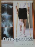 OSTEOPOROZA CAUZE SI PREVENIRE-EMIL RADULESCU