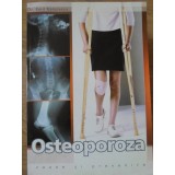 OSTEOPOROZA CAUZE SI PREVENIRE-EMIL RADULESCU-278726