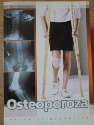 OSTEOPOROZA CAUZE SI PREVENIRE-EMIL RADULESCU foto