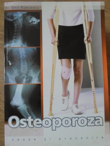 OSTEOPOROZA CAUZE SI PREVENIRE-EMIL RADULESCU