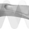 MOTAQUIP LVSL1476 Brat/bieleta suspensie, stabilizator