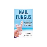 Nail Fungus: How to Naturally Cure Nail Fungus in 30 Days: Natural Remedies, Homeopathy for Toenail Fungus