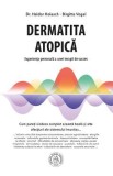 Dermatita atopica. Experienta personala a unei terapii de succes - Haldor Holesch, Birgitta Vogel