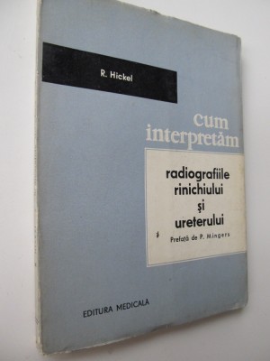 Cum interpretam Radiografiile rinichiului si ureterului - R. Hickel foto