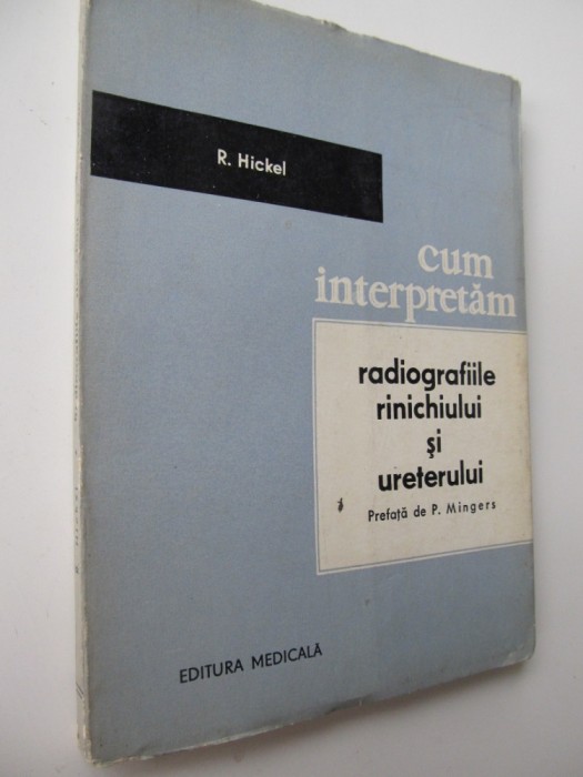 Cum interpretam Radiografiile rinichiului si ureterului - R. Hickel