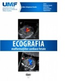 Ecografia Malformatiilor Cardiace Fetale. Brosura + DVD - Claudiu Marginean, Liliana Gozar, Iolanda Muntean, Rodica Toganel