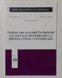 Tehnica Realizarii Inchiderii Palatinale Posterioare La Proteza Totala Superioar