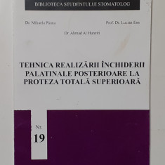 Tehnica Realizarii Inchiderii Palatinale Posterioare La Proteza Totala Superioar