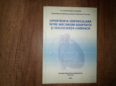 HIPERTROFIA VENTRICULARA INTRE MECANISM ADAPTATIV SI INSUFICIENTA CARDIACA foto