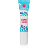 Dermacol Acne Clear ingrijire intensiva pentru pielea problematica fără parfum 15 ml