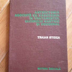 Antrectomia Asociata Cu Vagotomia In Tratamentul Ulcerului Ga - Traian Stoica ,297836