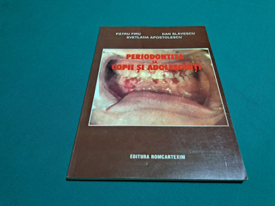 PERIODONTITA LA COPII ȘI ADOLESCENȚI / PĂTRU FIRU, DAN SLĂVESCU /1998 * foto