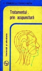 Tratamentul prin acupunctura - C. Ionescu Tirgoviste foto