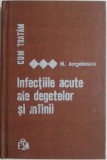 Cum tratam infectiile acute ale degetelor si mainii - Nicolae M. Angelescu - Carte Medicina