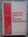 Stelica Dumitrescu - Edentatia partiala si proteza mobilizabila