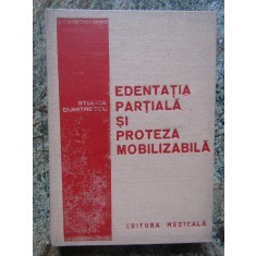 Stelica Dumitrescu - Edentatia partiala si proteza mobilizabila