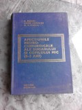 AFECTIUNI NEURO-CHIRURGICALE ALE SUGARULUI SI COPILULUI MIC (0-3 ANI) - C. ARSENI, LENKE HORVATH, A.V. CIUREA