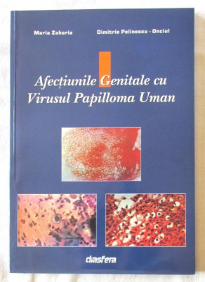 AFECTIUNILE GENITALE CU VIRUSUL PAPILLOMA UMAN, M. Zaharia / D Pelinescu-Onciul foto