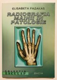 Radiografia mainii mainilor in patologie, Elisabeta Fazakas, radiodiagnostic osteoarticular, reumatologie, ortopedie, radiologie medicala,radiografie, 1999, Dacia